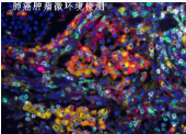 江苏多标记免疫组化检测服务 欢迎咨询 上海朝瑞生物科技供应